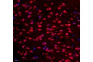 Immunofluorescence of paraffin embedded mouse prefrontal lobe using NCBP2 (ABIN7074870) at dilution of 1: 650 (400x lens) (NCBP2 antibody)