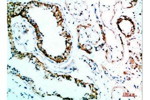 Immunohistochemical analysis of paraffin-embedded human-testis, antibody was diluted at 1:200 (IL-31 antibody  (AA 21-70))