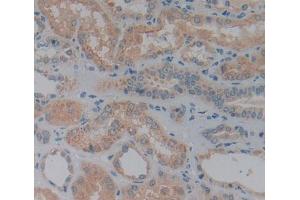 Used in DAB staining on fromalin fixed paraffin- embedded Kidney tissue (DPP7 antibody  (AA 28-486))