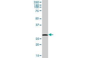 FKBP3 MaxPab polyclonal antibody. (FKBP3 antibody  (AA 1-224))