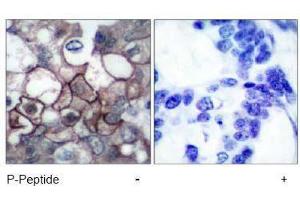 Image no. 2 for anti-Epidermal Growth Factor Receptor (EGFR) (pTyr1197) antibody (ABIN196974) (EGFR antibody  (pTyr1197))
