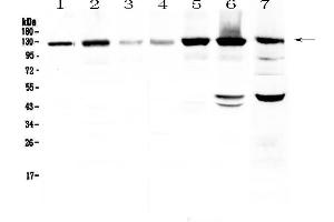 Western blot analysis of Eph receptor A2  using anti-Eph receptor A2  antibody . (EPH Receptor A2 antibody  (AA 851-970))