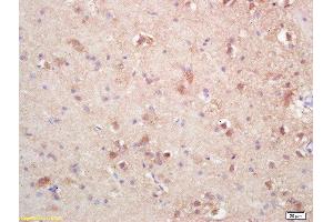 Formalin-fixed and paraffin embedded rat brain labeled with Rabbit Anti SOAT2/ACAT2 Polyclonal Antibody, Unconjugated  at 1:200 followed by conjugation to the secondary antibody and DAB staining (SOAT2 antibody  (AA 331-430))