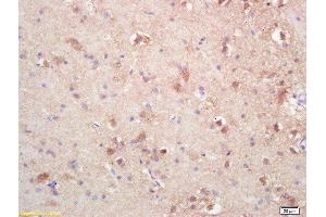 Formalin-fixed and paraffin embedded rat brain labeled with Rabbit Anti SOAT2/ACAT2 Polyclonal Antibody, Unconjugated  at 1:200 followed by conjugation to the secondary antibody and DAB staining