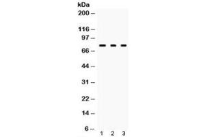 Western blot testing of TGM2 antibody and Lane 1:  rat liver, 2.