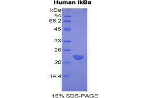 SDS-PAGE analysis of Human IkBa Protein. (Inhibitory Subunit Of NF kappa B alpha Protein)
