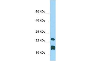 WB Suggested Anti-Lmo1 Antibody Titration: 1. (LMO1 antibody  (C-Term))