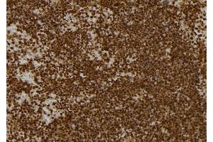 ABIN6262736 and ABIN6277134 at 1/100 staining Mouse spleen tissue by IHC-P. (KBTBD3 antibody  (C-Term))