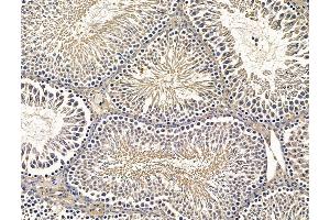 anti-Ectopic P-Granules Autophagy Protein 5 Homolog (EPG5) antibody