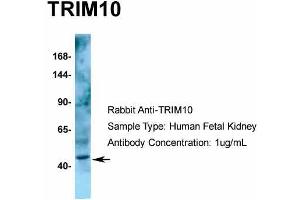 Host: Rabbit  Target Name: TRIM10  Sample Tissue: Human Fetal Kidney  Antibody Dilution: 1.