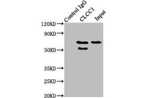 Immunoprecipitating CLCC1 in HepG2 whole cell lysate Lane 1: Rabbit control IgG instead of ABIN7147569 in HepG2 whole cell lysate. (CLCC1 antibody  (AA 446-551))