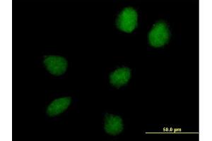 Immunofluorescence of purified MaxPab antibody to C17orf66 on HeLa cell.