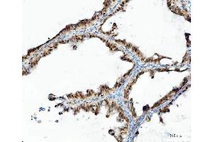 IHC analysis of UBA6 using anti-UBA6 antibody (ABIN7602559). (UBA6 antibody  (AA 85-1033))
