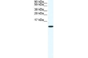 WB Suggested Anti-CCL5 Antibody Titration:  1. (CCL5 antibody  (Middle Region))