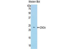 Western Blotting (WB) image for anti-TIMP Metallopeptidase Inhibitor 4 (TIMP4) (AA 42-224) antibody (ABIN1172385) (TIMP4 antibody  (AA 42-224))