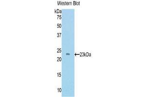 Western Blotting (WB) image for anti-TIMP Metallopeptidase Inhibitor 4 (TIMP4) (AA 42-224) antibody (ABIN1172385)