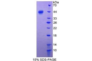 SDS-PAGE (SDS) image for S100 Calcium Binding Protein A2 (S100A2) (AA 2-98) protein (His tag,GST tag) (ABIN2123572)