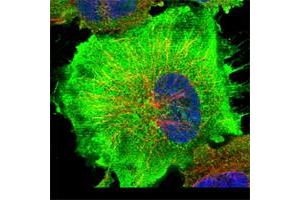 Immunofluorescent staining of human cell line U-251 MG shows positivity in plasma membrane & cytoplasm.