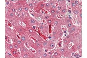 Human Liver (formalin-fixed, paraffin-embedded) stained with FTH1at 4 µg/ml followed by biotinylated anti-goat IgG secondary antibody, alkaline phosphatase-streptavidin and chromogen. (FTH1 antibody  (C-Term, Heavy Chain))