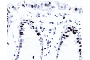 Anti-human p21, ABIN967528. (p21 antibody)