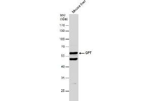WB Image Mouse tissue extract (50 μg) was separated by 10% SDS-PAGE, and the membrane was blotted with GPT antibody [N1N3] , diluted at 1:500. (ALT antibody  (N-Term))