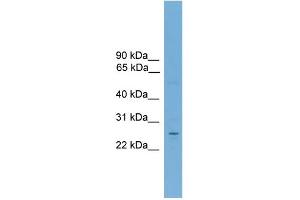 WB Suggested Anti-NR6A1 Antibody Titration:  0. (NR6A1 antibody  (Middle Region))