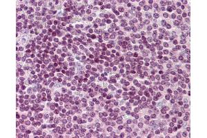 Immunohistochemistry (IHC) image for anti-Cell Division Cycle 20 Homolog (S. Cerevisiae) (CDC20) (N-Term) antibody (ABIN2774602) (CDC20 antibody  (N-Term))