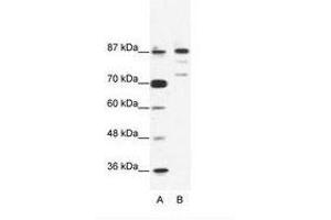 Image no. 1 for anti-BTB and CNC Homology 1, Basic Leucine Zipper Transcription Factor 1 (BACH1) (C-Term) antibody (ABIN203248) (BACH1 antibody  (C-Term))
