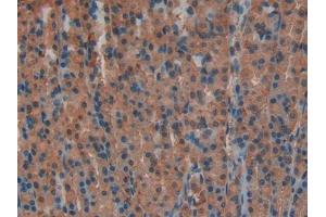 DAB staining on IHC-P; Samples: Rat Stomach Tissue (Lactate Dehydrogenase A antibody  (AA 1-332))