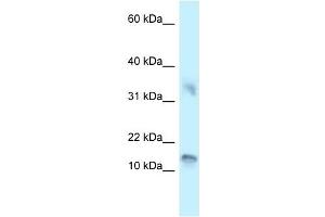 Western Blot showing UTS2D antibody used at a concentration of 1 ug/ml against 721_B Cell Lysate (Urotensin 2B antibody  (C-Term))