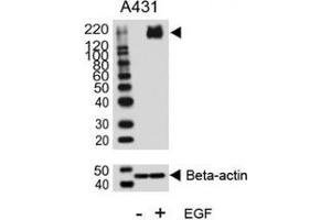 Western blot analysis of lysate from A431 cell line, untreated or treated with EGF (100ng/ml), using phospho-ErbB2 antibody. (ErbB2/Her2 antibody  (pTyr1140))