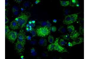Image no. 1 for anti-Hydroxysteroid (17-Beta) Dehydrogenase 10 (HSD17B10) antibody (ABIN1498724) (HSD17B10 antibody)