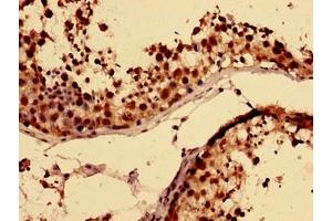 Immunohistochemistry of paraffin-embedded human testis tissue using ABIN7168309 at dilution of 1:100 (RBMY1A1 antibody  (AA 1-459))