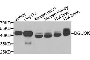 Western blot analysis of extracts of various cell lines, using DGUOK antibody. (Deoxyguanosine Kinase antibody)