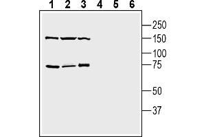 anti-Transmembrane Protein 108 (TMEM108) (AA 208-223), (Extracellular Loop) antibody