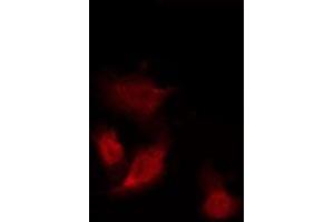 ABIN6275960 staining Hela by IF/ICC. (GPR153 antibody  (Internal Region))