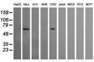 Image no. 3 for anti-Chaperonin Containing TCP1, Subunit 8 (Theta)-Like 2 (CCT8L2) antibody (ABIN1497482) (CCT8L2 antibody)