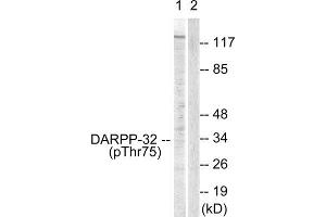 Western Blotting (WB) image for anti-Protein Phosphatase 1, Regulatory (Inhibitor) Subunit 1B (PPP1R1B) (pThr75) antibody (ABIN1847208)