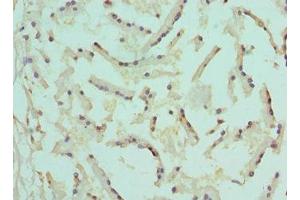 Immunohistochemistry of paraffin-embedded human prostate tissue using ABIN7148788 at dilution of 1:100 (AFT1 antibody  (AA 1-210))