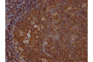 IHC image of ABIN7127806 diluted at 1:100 and staining in paraffin-embedded human tonsil tissue performed on a Leica BondTM system. (Recombinant INPP5D antibody)