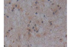Immunohistochemistry (IHC) image for anti-Toll-Like Receptor 9 (TLR9) (AA 28-362) antibody (ABIN7432445)