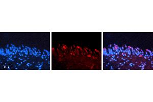 Rabbit Anti-SMAD3 Antibody   Formalin Fixed Paraffin Embedded Tissue: Human Urinary Bladder Tissue Observed Staining: Cytoplasm Primary Antibody Concentration: 1:100 Other Working Concentrations: N/A Secondary Antibody: Donkey anti-Rabbit-Cy3 Secondary Antibody Concentration: 1:200 Magnification: 20X Exposure Time: 0. (SMAD3 antibody  (N-Term))