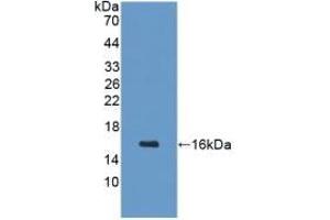 Detection of Recombinant GHRH, Mouse using Polyclonal Antibody to Growth Hormone Releasing Hormone (GHRH) (GHRH antibody  (AA 20-97))