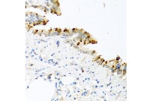 Immunohistochemistry of paraffin-embedded mouse lung using BMP4 antibody (ABIN5997308) at dilution of 1/100 (40x lens). (BMP4 antibody)