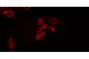 ABIN6275428 staining HepG2 by IF/ICC. (PDXDC1 antibody  (C-Term))