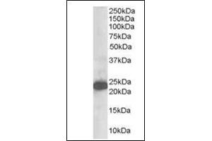 Western analysis (1 µg/ml) of Human Brain lysate (RIPA buffer, 35 µg total protein per lane). (STMN2 antibody  (N-Term))