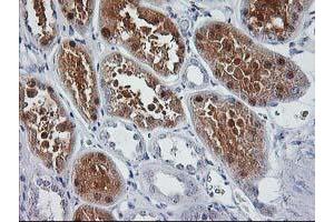 Immunohistochemical staining of paraffin-embedded Human Kidney tissue using anti-SIRT5 mouse monoclonal antibody.