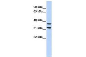 Image no. 1 for anti-Zinc Finger Protein 254 (ZNF254) (AA 151-200) antibody (ABIN6744476)