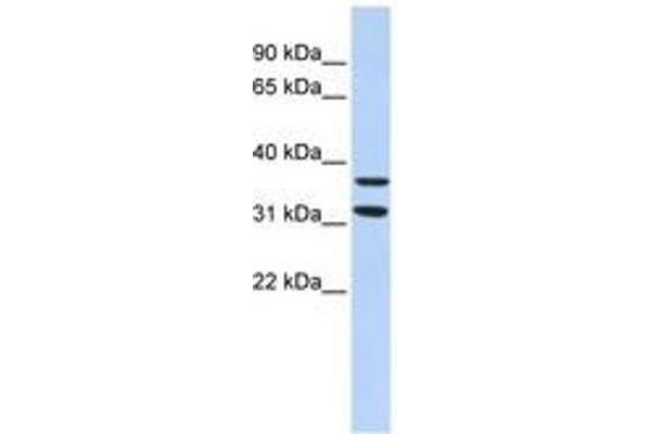 ZNF254 Antikörper  (AA 151-200)