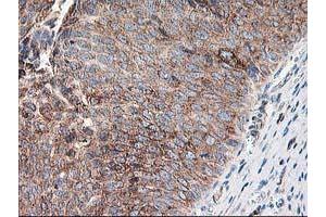 Image no. 9 for anti-Ribophorin 1 (RPN1) antibody (ABIN1500748)